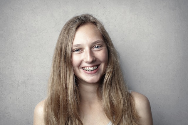 Why Braces Are Worth the Investment